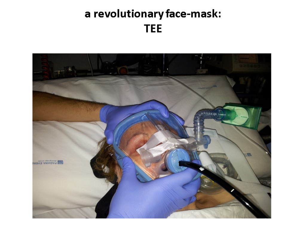 a revolutionary face-mask: TEE